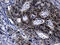 Homeobox protein CDX-1 antibody, M04522, Boster Biological Technology, Immunohistochemistry paraffin image 