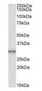 CA1 antibody, orb20280, Biorbyt, Western Blot image 