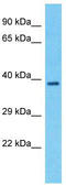 Lipase Maturation Factor 1 antibody, TA338619, Origene, Western Blot image 