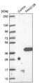 Uncharacterized protein C1orf183 antibody, NBP1-93887, Novus Biologicals, Western Blot image 