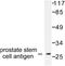 Prostate Stem Cell Antigen antibody, AP06293PU-N, Origene, Western Blot image 