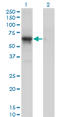 Cyclin Dependent Kinase 16 antibody, LS-C133368, Lifespan Biosciences, Western Blot image 