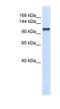 Calcium Homeostasis Endoplasmic Reticulum Protein antibody, NBP1-80457, Novus Biologicals, Western Blot image 