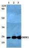 ORM1 antibody, GTX66776, GeneTex, Western Blot image 