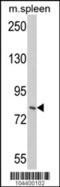 Hepatocyte Growth Factor-Regulated Tyrosine Kinase Substrate antibody, 61-121, ProSci, Western Blot image 