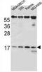Protein AATF antibody, AP54207PU-N, Origene, Western Blot image 