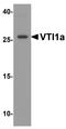 Vesicle Transport Through Interaction With T-SNAREs 1A antibody, A06649-1, Boster Biological Technology, Western Blot image 