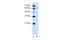 Solute Carrier Family 15 Member 4 antibody, A06768-1, Boster Biological Technology, Western Blot image 