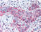 Matrix Metallopeptidase 13 antibody, TA341183, Origene, Immunohistochemistry paraffin image 