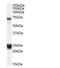Huntingtin-associated protein 1 antibody, NB100-55413, Novus Biologicals, Western Blot image 