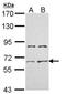 Activin receptor type IIA antibody, TA308578, Origene, Western Blot image 