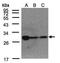 Caseinolytic Mitochondrial Matrix Peptidase Proteolytic Subunit antibody, TA308333, Origene, Western Blot image 