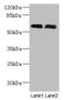 Patatin Like Phospholipase Domain Containing 1 antibody, LS-C397579, Lifespan Biosciences, Western Blot image 