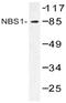 Nibrin antibody, AP20504PU-N, Origene, Western Blot image 
