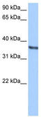 Chondroadherin antibody, TA340001, Origene, Western Blot image 