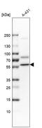 H/ACA ribonucleoprotein complex subunit 4 antibody, HPA001022, Atlas Antibodies, Western Blot image 
