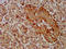 Gem Nuclear Organelle Associated Protein 4 antibody, LS-C672211, Lifespan Biosciences, Immunohistochemistry paraffin image 