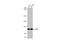 ERCC Excision Repair 4, Endonuclease Catalytic Subunit antibody, GTX129286, GeneTex, Western Blot image 