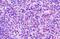 C-C Motif Chemokine Receptor 7 antibody, MBS244376, MyBioSource, Immunohistochemistry frozen image 