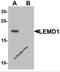 LEM Domain Containing 1 antibody, 6599, ProSci, Western Blot image 