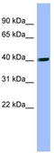 Phosphatidylinositol-5-Phosphate 4-Kinase Type 2 Alpha antibody, TA342234, Origene, Western Blot image 
