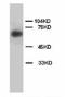 Laminin Subunit Beta 1 antibody, LS-C171769, Lifespan Biosciences, Western Blot image 