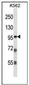 Plakophilin 2 antibody, AP53319PU-N, Origene, Western Blot image 
