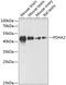 Pyruvate Dehydrogenase E1 Alpha 2 Subunit antibody, 15-336, ProSci, Western Blot image 