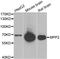 Membrane Palmitoylated Protein 2 antibody, A6659, ABclonal Technology, Western Blot image 