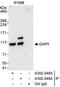 Eukaryotic Translation Initiation Factor 4 Gamma 2 antibody, A302-248A, Bethyl Labs, Immunoprecipitation image 