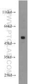 Friend leukemia integration 1 transcription factor antibody, 11347-1-AP, Proteintech Group, Western Blot image 