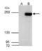AT-Rich Interaction Domain 2 antibody, GTX129444, GeneTex, Immunoprecipitation image 