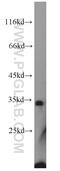 NPHS2 Stomatin Family Member, Podocin antibody, 20384-1-AP, Proteintech Group, Western Blot image 