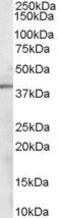 SDH antibody, GTX89635, GeneTex, Western Blot image 