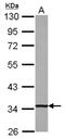 2,4-Dienoyl-CoA Reductase 1 antibody, NBP2-16144, Novus Biologicals, Western Blot image 