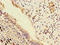 Phospholipid Phosphatase 3 antibody, LS-C397055, Lifespan Biosciences, Immunohistochemistry paraffin image 