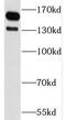 Sperm-associated antigen 5 antibody, FNab08143, FineTest, Western Blot image 