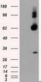 Atrial natriuretic peptide receptor 3 antibody, GTX84008, GeneTex, Western Blot image 