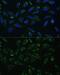 Holocytochrome C Synthase antibody, GTX33236, GeneTex, Immunocytochemistry image 