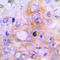 Bone Morphogenetic Protein 2 antibody, LS-C351876, Lifespan Biosciences, Immunohistochemistry paraffin image 