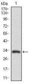 ATP Binding Cassette Subfamily C Member 4 antibody, NBP2-37347, Novus Biologicals, Western Blot image 