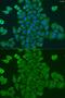 Dolichyl-Phosphate Mannosyltransferase Subunit 1, Catalytic antibody, GTX33163, GeneTex, Immunofluorescence image 