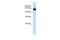 Zinc Finger BED-Type Containing 9 antibody, PA5-69496, Invitrogen Antibodies, Western Blot image 