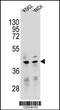 Transcription Factor B2, Mitochondrial antibody, 55-058, ProSci, Western Blot image 