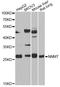 Nicotinamide N-Methyltransferase antibody, LS-C749045, Lifespan Biosciences, Western Blot image 