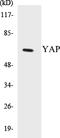 Yes Associated Protein 1 antibody, EKC1606, Boster Biological Technology, Western Blot image 
