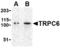 Short transient receptor potential channel 6 antibody, TA306349, Origene, Western Blot image 