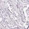 Melanoma inhibitory activity protein 2 antibody, HPA055459, Atlas Antibodies, Immunohistochemistry paraffin image 