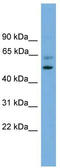 Proteasome 26S Subunit, Non-ATPase 12 antibody, TA344574, Origene, Western Blot image 