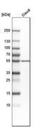 Protein Kinase CAMP-Dependent Type II Regulatory Subunit Beta antibody, HPA008421, Atlas Antibodies, Western Blot image 